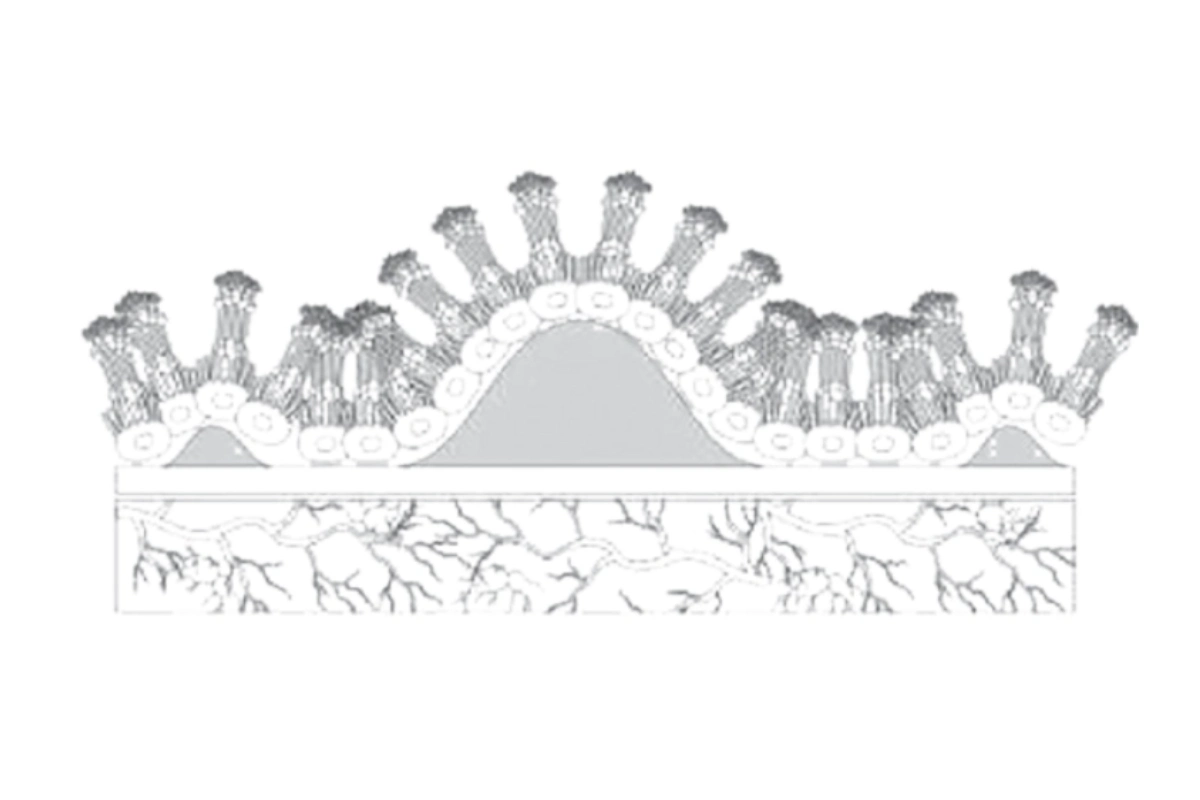 Dry AMD
