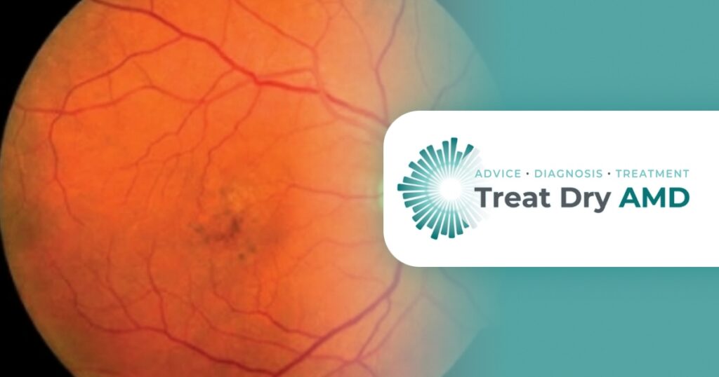 Dry AMD Symptoms